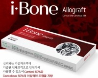 i-Bone Allograft